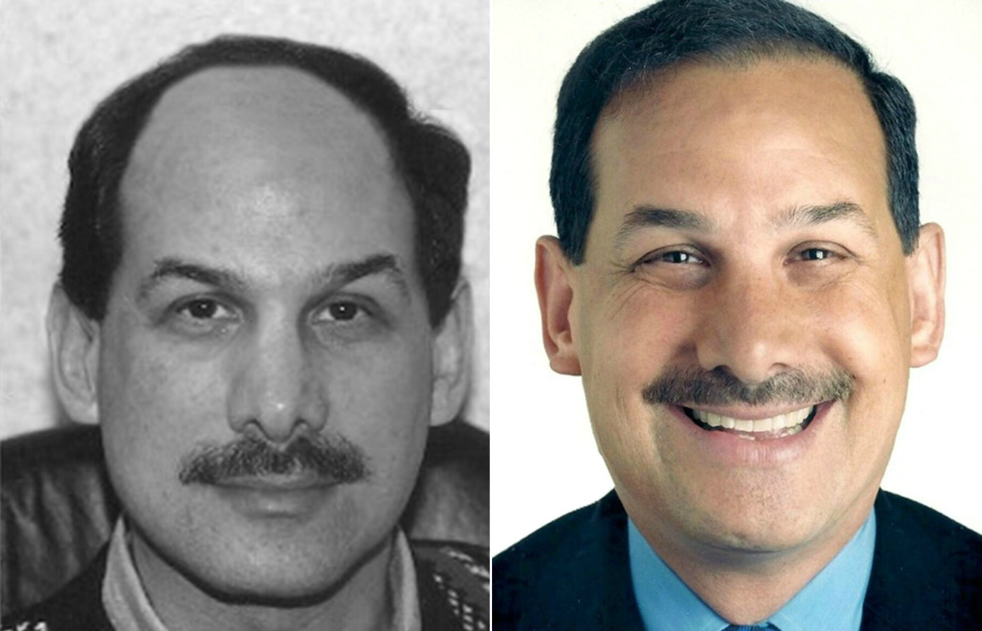 Before and After