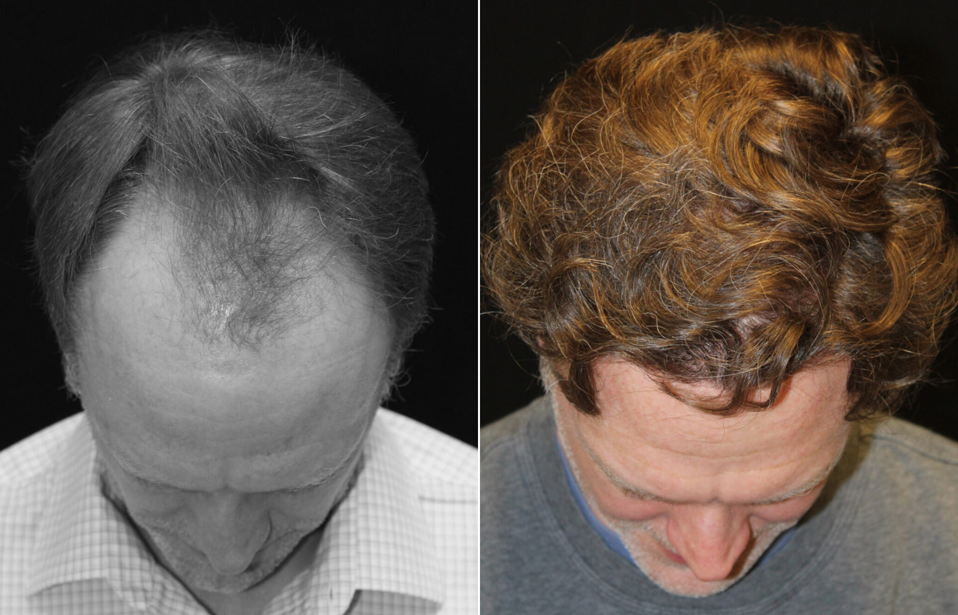 Before and After